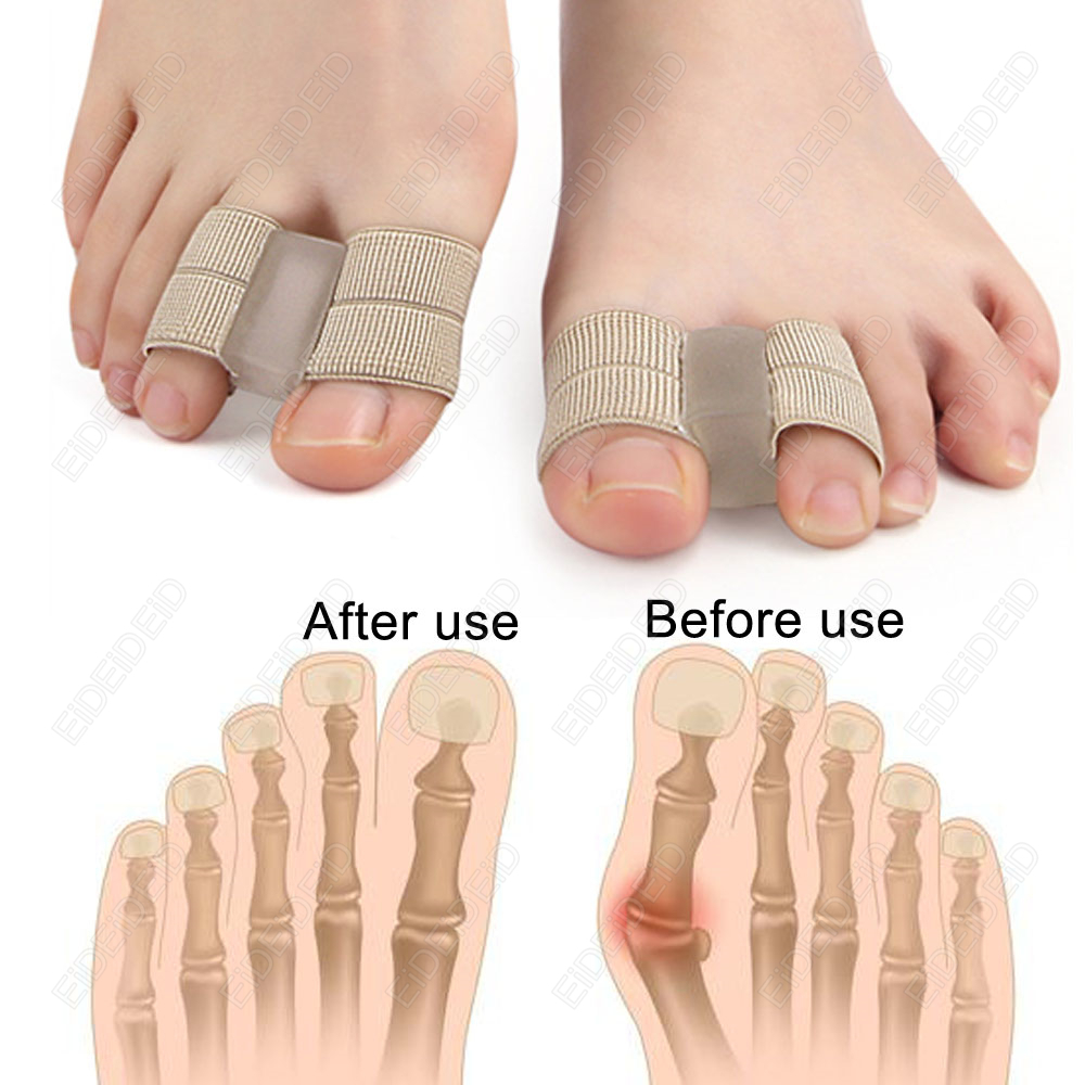 Bunion toe Corrector Orthotics - Women'S Shoes For Bunions บทวิจารณ์และราคา